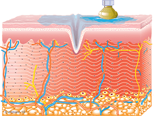 Collagen begins