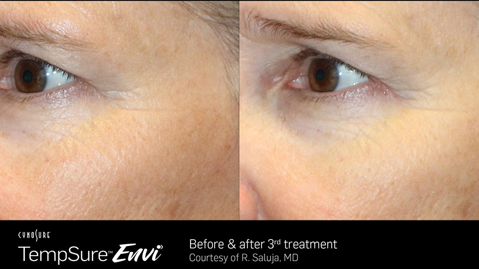 before and after photos