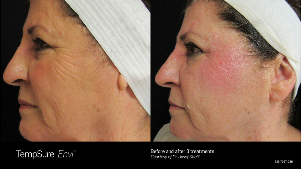 Before and after photos