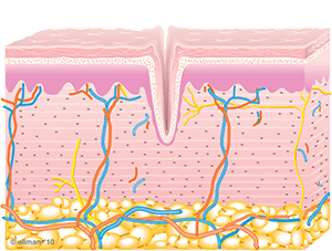 Untreated skin